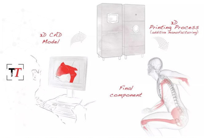 骨科3D打?。汗怩r外衣掩蓋下的骨感賽道