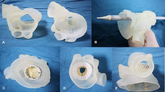 逐漸納入醫(yī)保范圍的3D打印模型，將會(huì)對醫(yī)工結(jié)合帶來哪些不同？